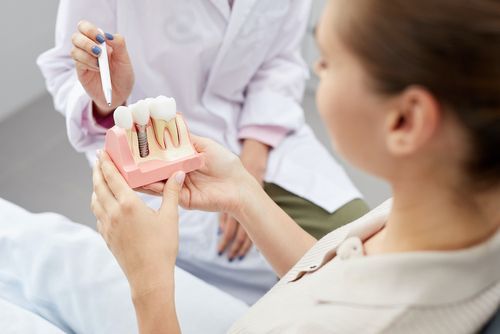 Dentist showing a patient what a dental implant looks like