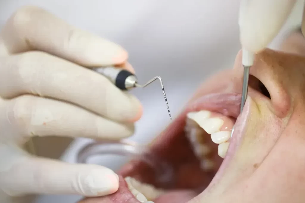 dentist performing gum disease treatment on a patient