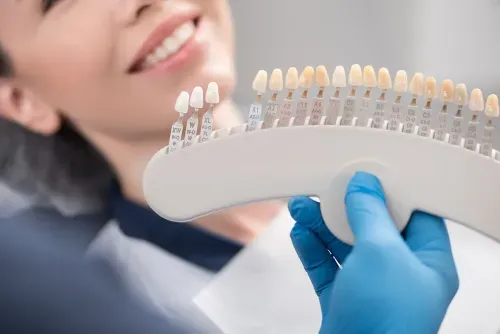 dentist showing a patient the shades of porcelain veneers