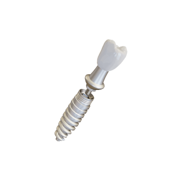 dental implant