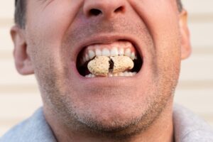 man opening a peanut with his teeth